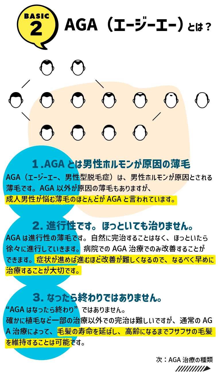 AGAとは？